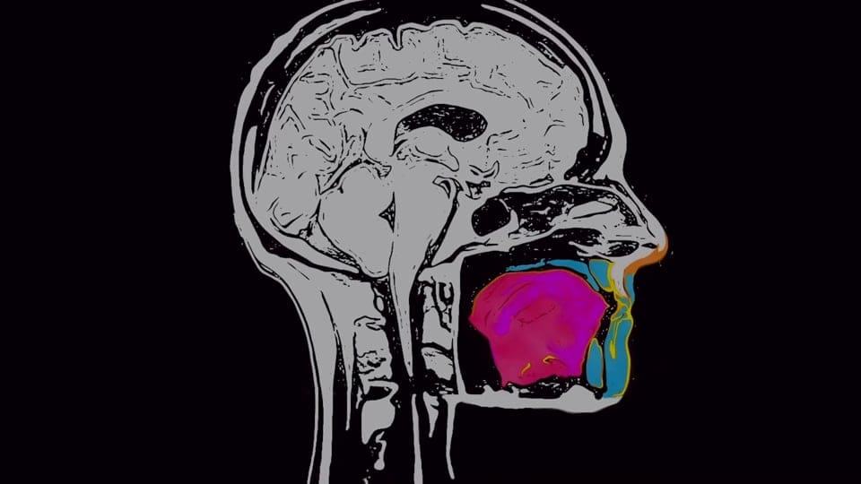 Illustration of an x-ray of a human head with multicolored splotches in the mouth area.